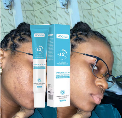 Super Gel Anti-Acné MOOYAM Acide Salicylique Salvia
Miltiorrhiza, Élimination de l'Acné, Dissolution des Impuretés, Désincrustation Profonde des Pores, Nettoyage en Profondeur, 20g

⭐️⭐️⭐️⭐️• 15640 vendus