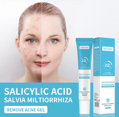 Super Gel Anti-Acné MOOYAM Acide Salicylique Salvia
Miltiorrhiza, Élimination de l'Acné, Dissolution des Impuretés, Désincrustation Profonde des Pores, Nettoyage en Profondeur, 20g

⭐️⭐️⭐️⭐️• 15640 vendus