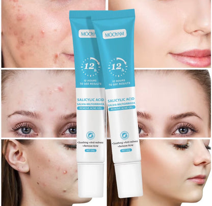 Super Gel Anti-Acné MOOYAM Acide Salicylique Salvia
Miltiorrhiza, Élimination de l'Acné, Dissolution des Impuretés, Désincrustation Profonde des Pores, Nettoyage en Profondeur, 20g

⭐️⭐️⭐️⭐️• 15640 vendus